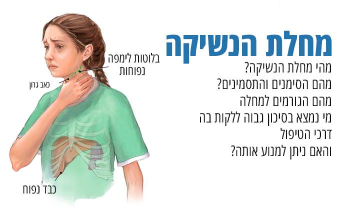 מחלת הנשיקה: תסמינים, גורמים ודרכי טיפול