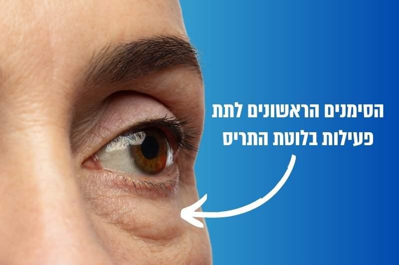 אלה הסימנים הראשונים של תת פעילות בלוטת התריס (איך מטפלים?)