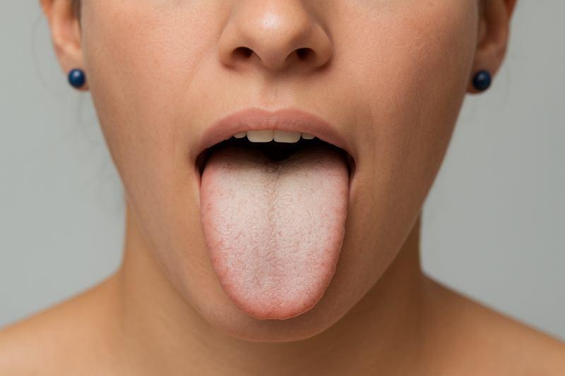 טעם מתכתי בפה – מה הגוף מסמן? למה זה קורה?