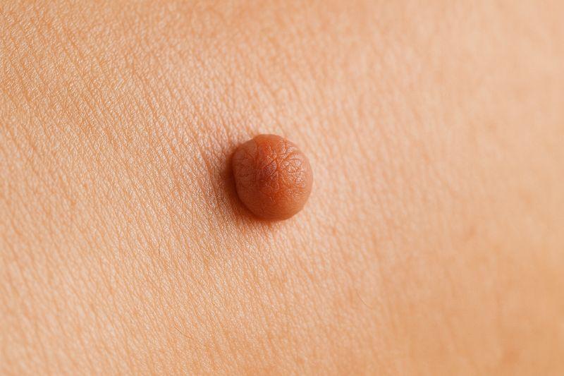 8 סימנים שיש לכם עמידות לאינסולין (טרום -סוכרת)