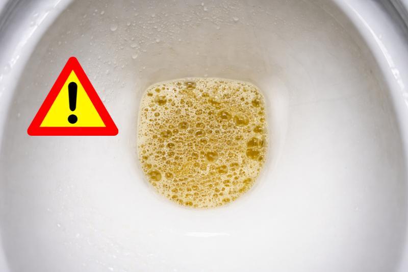 5 אותות אזהרה שהכליות שולחות במצוקה ומה כדאי לעשות