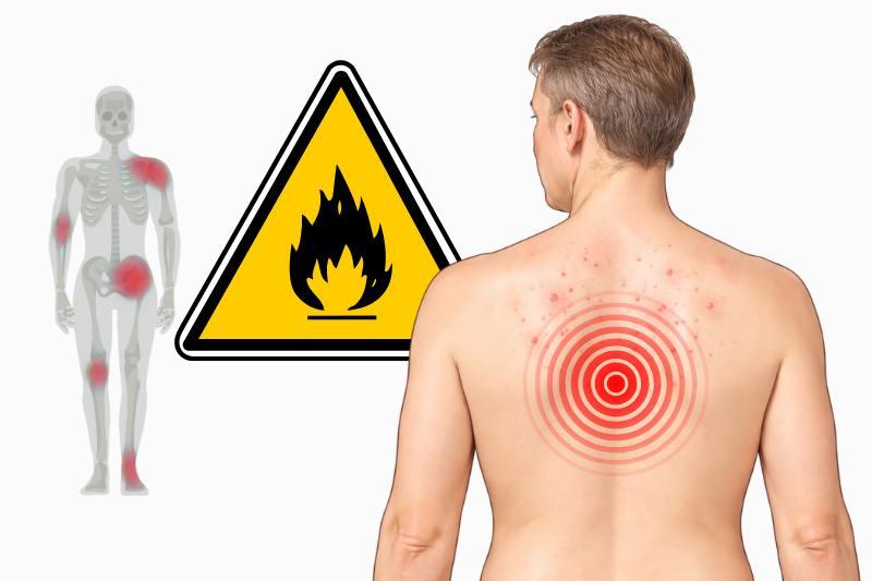 8 סימנים שיכולים לרמוז על דלקת כרונית שקטה בגוף