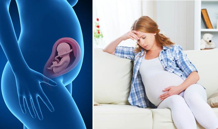 הריון בסיכון גבוה: גורמים, אבחון, מניעה והתמודדות