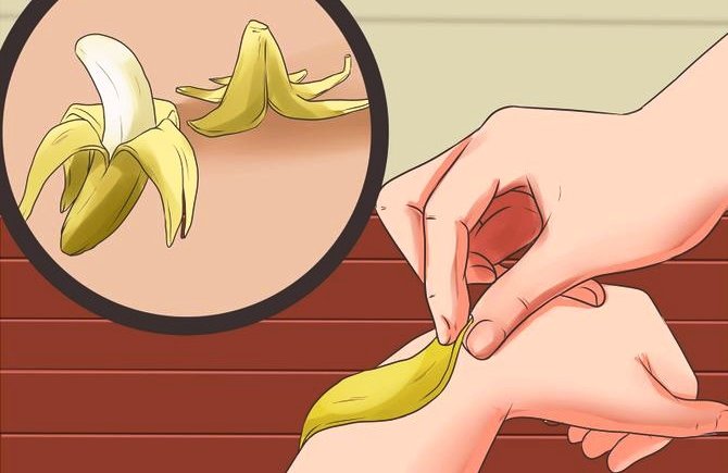 איך לטפל בעקיצת יתוש?